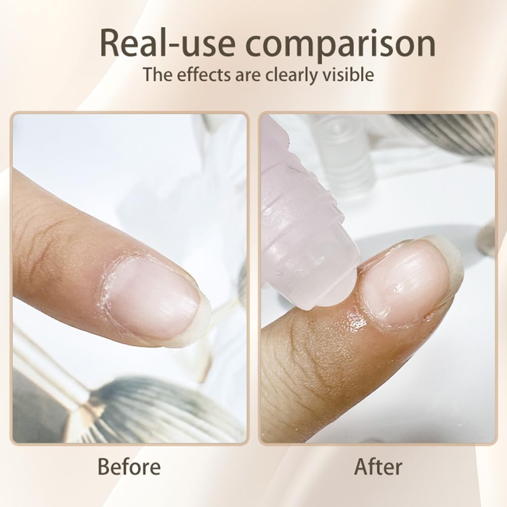 5pcs Cuticle Oil Roller Nourishing Moisturizing Roll On Cuticle Oil for Convenient Portable Nail Rollerball for On the Go Hydration and Care