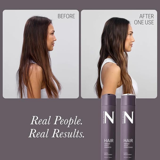 NULASTIN Vibrant Scalp Conditioner - Volumizing Hair Conditioner for Women & Men - Reduce Frizz & Breakage - Enhance Shine - Clinically Tested & Color-Safe - Silicone-Free & Vegan (10 Fl Oz)