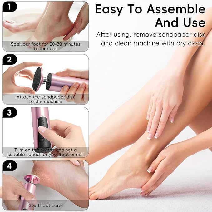 Electric Callus Remover,CHNYNJN Foot File Grinder Tool with Speed Controller and 20pcs Replacement Sandpaper and 10 Sand Rings Disk for Men Women Dead Dry Crack Skin Calluses