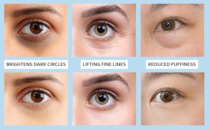 5% Caffeine Eye Serum, Under Eye Roller Cream for Dark Circles and Puffiness with 360°Massage Ball Reduce Wrinkles and Fine Lines，Bags Under Eyes，15ML