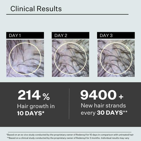 Stem Cell Serum for Men & Women - Helps Reduce Hair Loss - Strengthens & Thickens - Plant-Based - Combats Thinning Hair - Healthy Longer Hair - Root Nourishing Night (PM) - 28ml