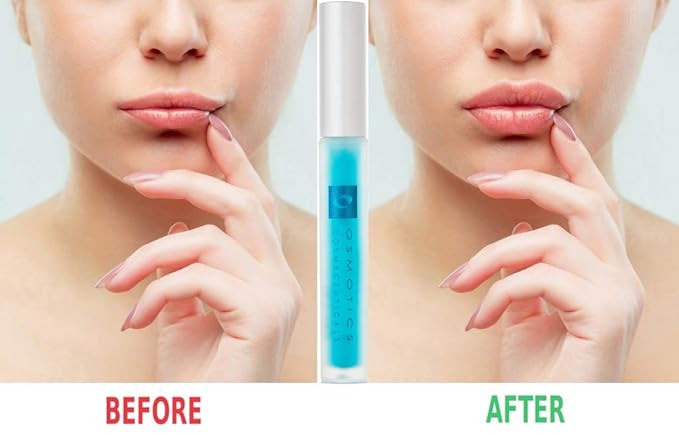Osmotics Lip Plumper, Best Natural Lip Enhancer, Lip Gloss With Hyaluronic Acid, Hydrating, High Shine, Increase Lip Elasticity, Get Fuller & Hydrated Youthful Sexy Looking Lips