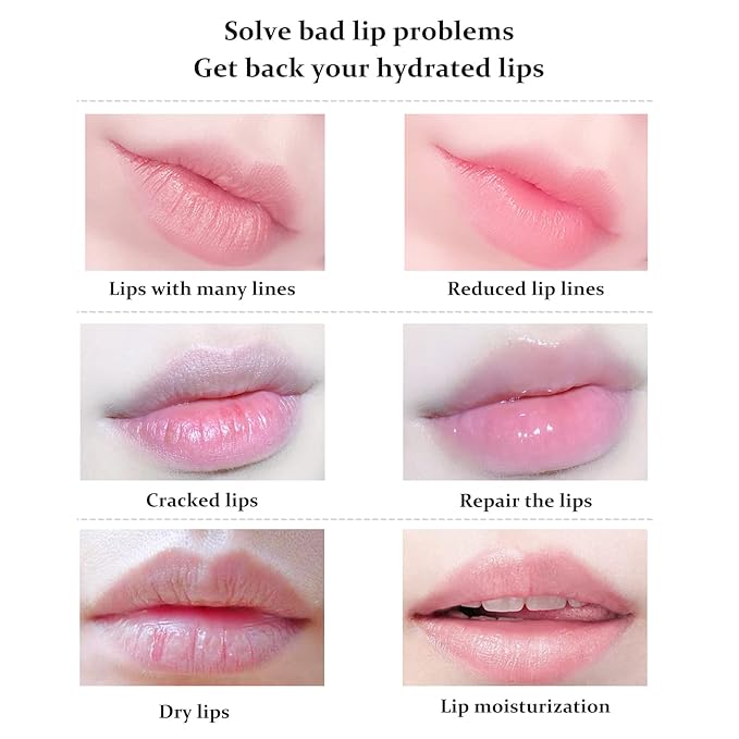 20Pcs Lip Mask, Red Cherry Lip Moisturizing Plumping Masks Overnight, Lip Gel Treatment Lip Masks for Dry Lips Smooth& Plump Chapped Lip Collagen Overnight Lip Care Pads Patches(Red)