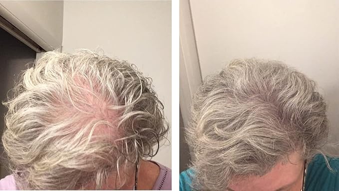 Hair Loss Concealer. Covers Bald Spot And Makes Thin Hair Look 10X Fuller Instantly. All-Natural Hair Building Fiber. Trial Size, 10-Day Supply. Gray