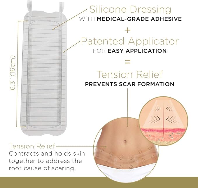 Embrace Active Scar Defense for New Tummy Tuck Scars, FDA-Cleared Extra-Large Silicone Scar Sheets, 30 Day Supply