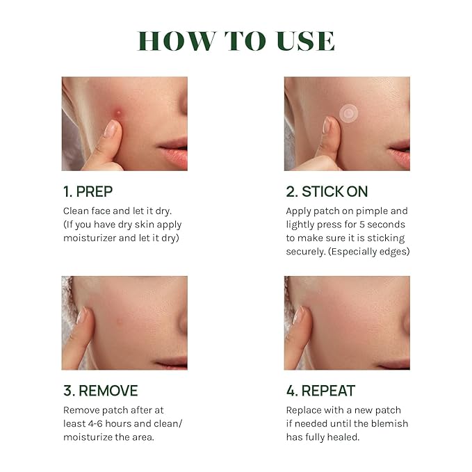 AOA Studio Absorbing Cover Healing Invisible Acne Patch Blemish Spot, Treatment, Facial Acne Patch Vegan, Cruelty Free, Hydrocolloid, Two Sizes 10mm 12mm (Total 84 Counts)