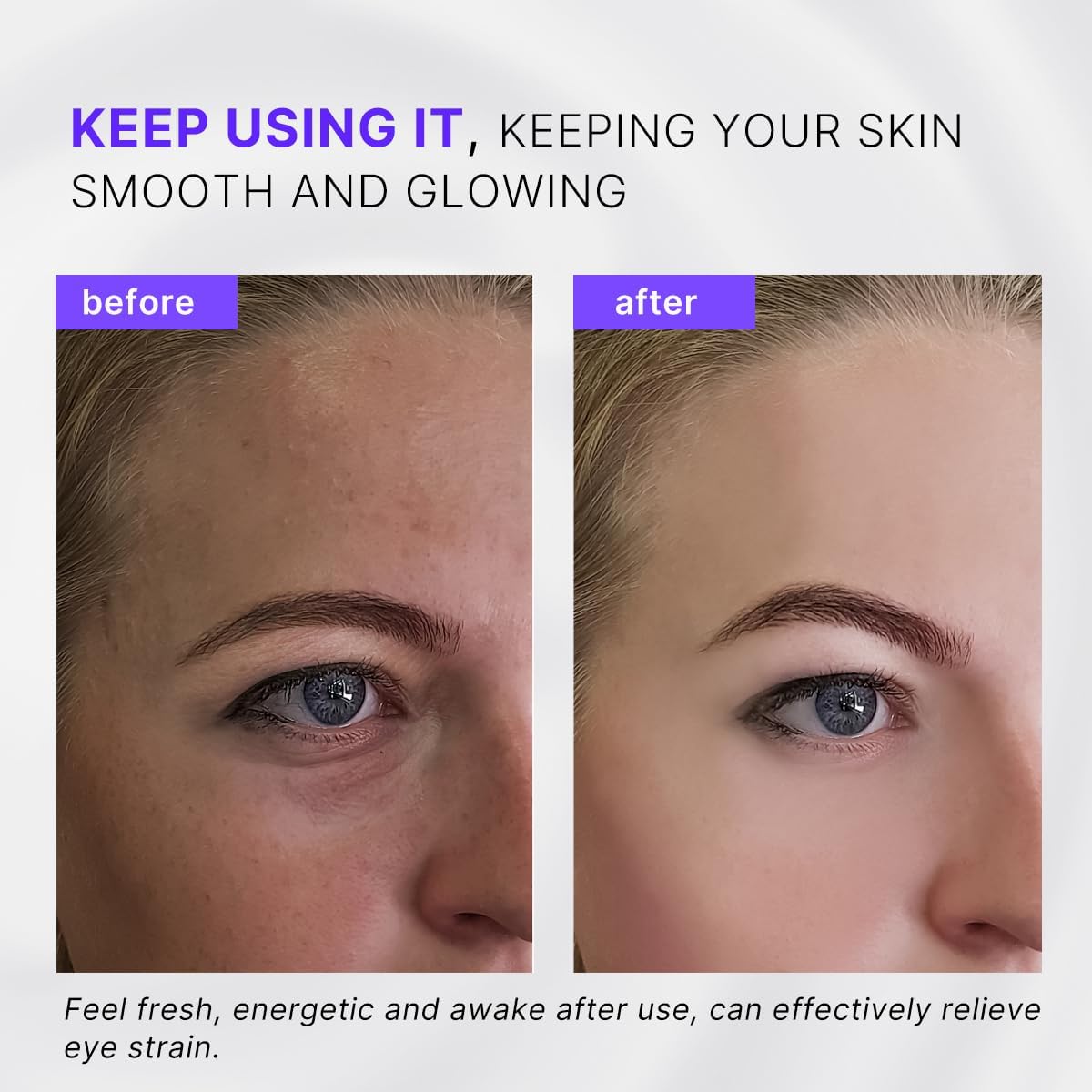 Eye Roller, Facial Roller Massager - Reduces Puffiness, Dark Circles, Cooling Therapy for Tired Eyes (with Applicator)