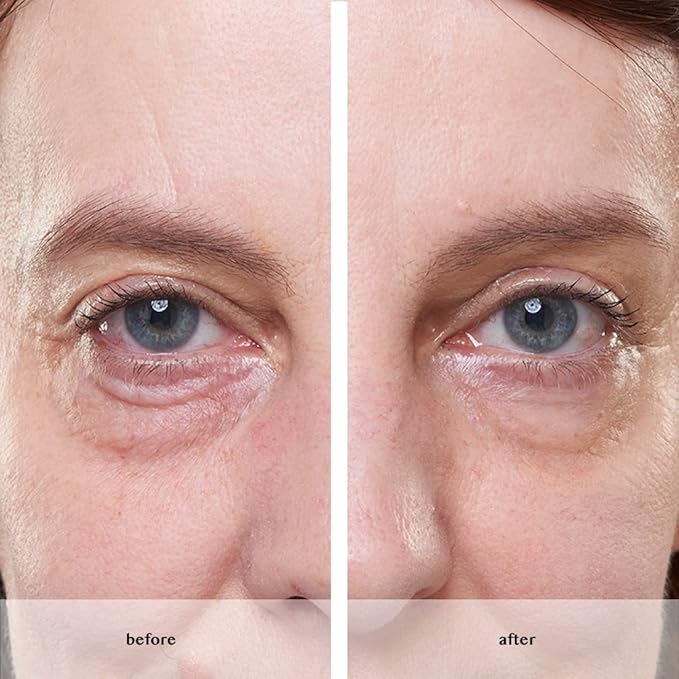 Avon ANEW Platinum Instant Eye Smoother for under eye bags/puffiness/wrinkles - Used Open seal