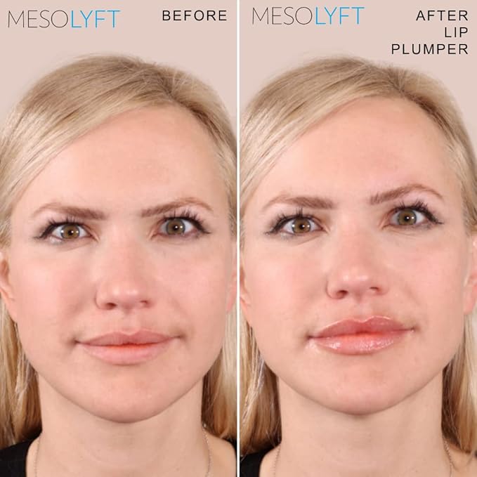 Neck & Lip Plumper Combo with Roller to Instantly Plump Lips & Neck - Neck Serum Improves the Neck Skin - Plumping Serum to Moisturize Your Lips and Neck