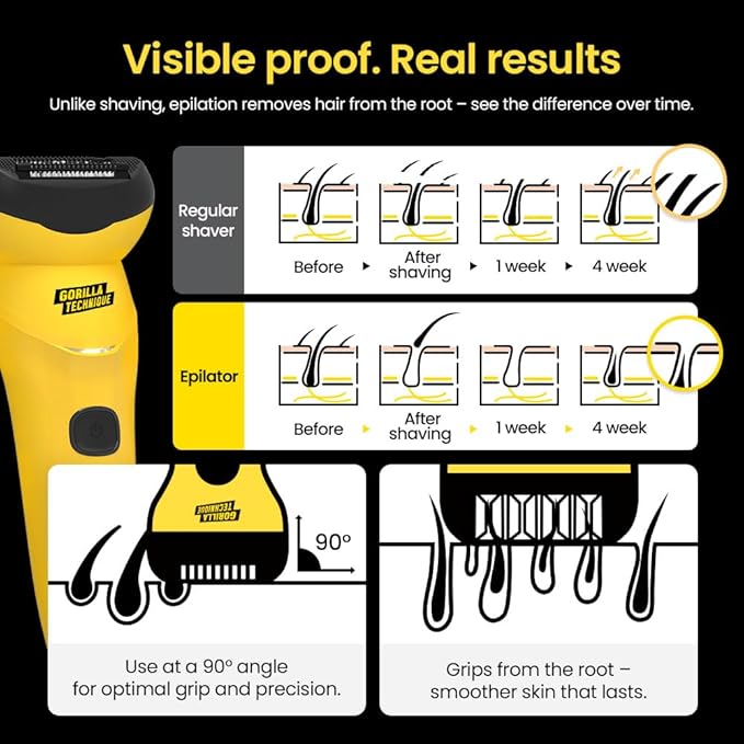 Gorilla Technique Epilator 3000V, Facial & Body Hair Removal Device, Pain Relief Roller, Cordless Rechargeable Electric Tweezers for Women & Men, Triple Tweezers, 8000RPM, Korean Skin Care - 3000V