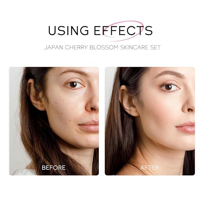 Greyghost Skin Care Set for Teenage Girls Women, 5 Pcs Cherry Blossom Skincare Set - Cleanser, Toner, Serum, Eye cream, Cream, Gentle Skin Cleaning & Care Gift Set, Travel Size Skin Care Set