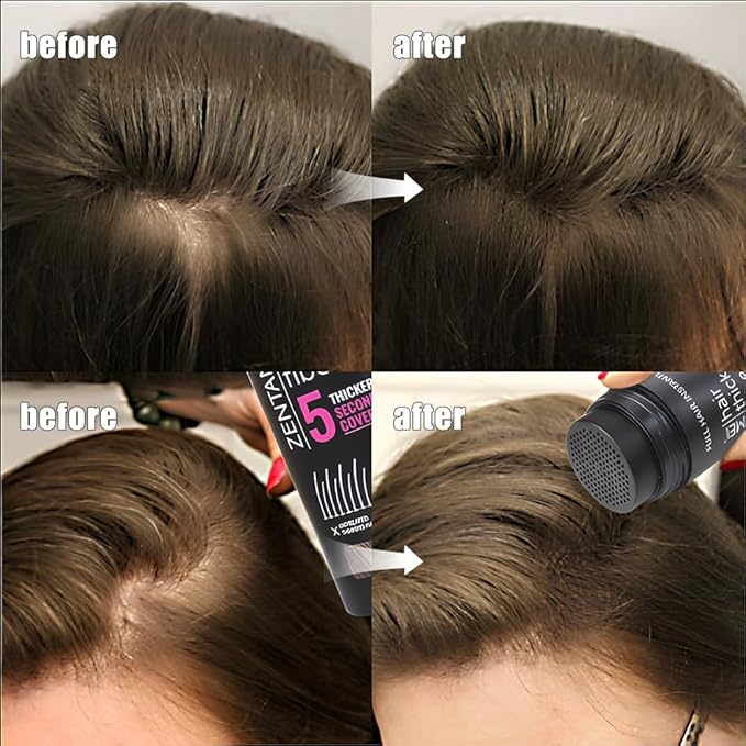 Hair Fibers for Thinning Hair for Women All-Natural Hair Building Fibers 0.98 Oz Hair Volume Powder Bald Spot Cover Up for Men & Women (Dark Brown)