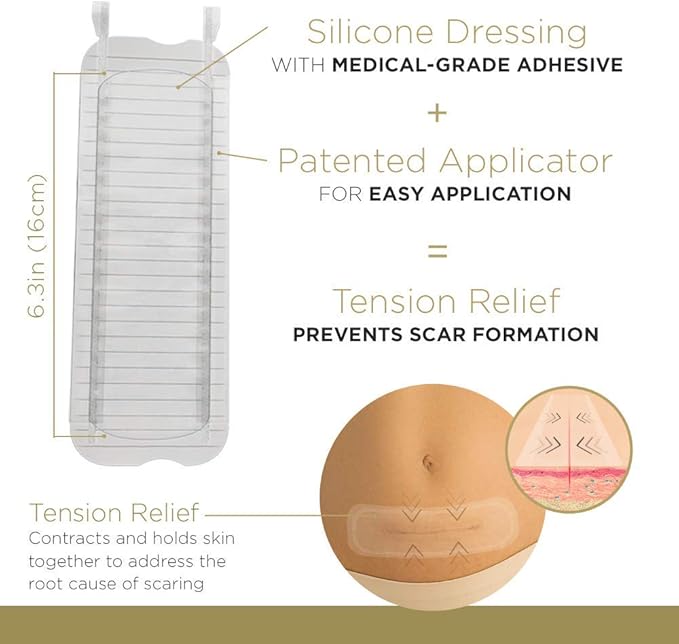 Embrace Active Scar Defense for New Scars, FDA-Cleared Medical-Grade Silicone Scar Sheets for Hypertrophic & Keloid Scar Treatment, 6.3 Inch, Extra-Large, 30-Day Supply