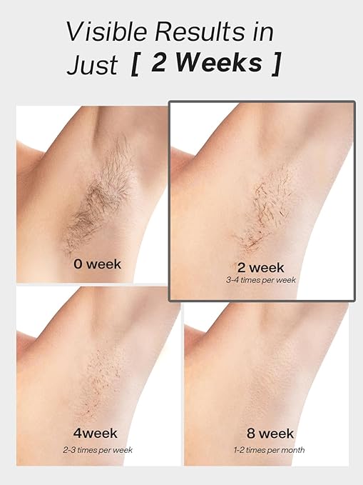 Blex Laser Hair Removal for Women and Men, IPL Hair Removal Device Effective in 2 Weeks, with Ultra-Fast 0.2s Light Emission, Comfortable and Painless, Black