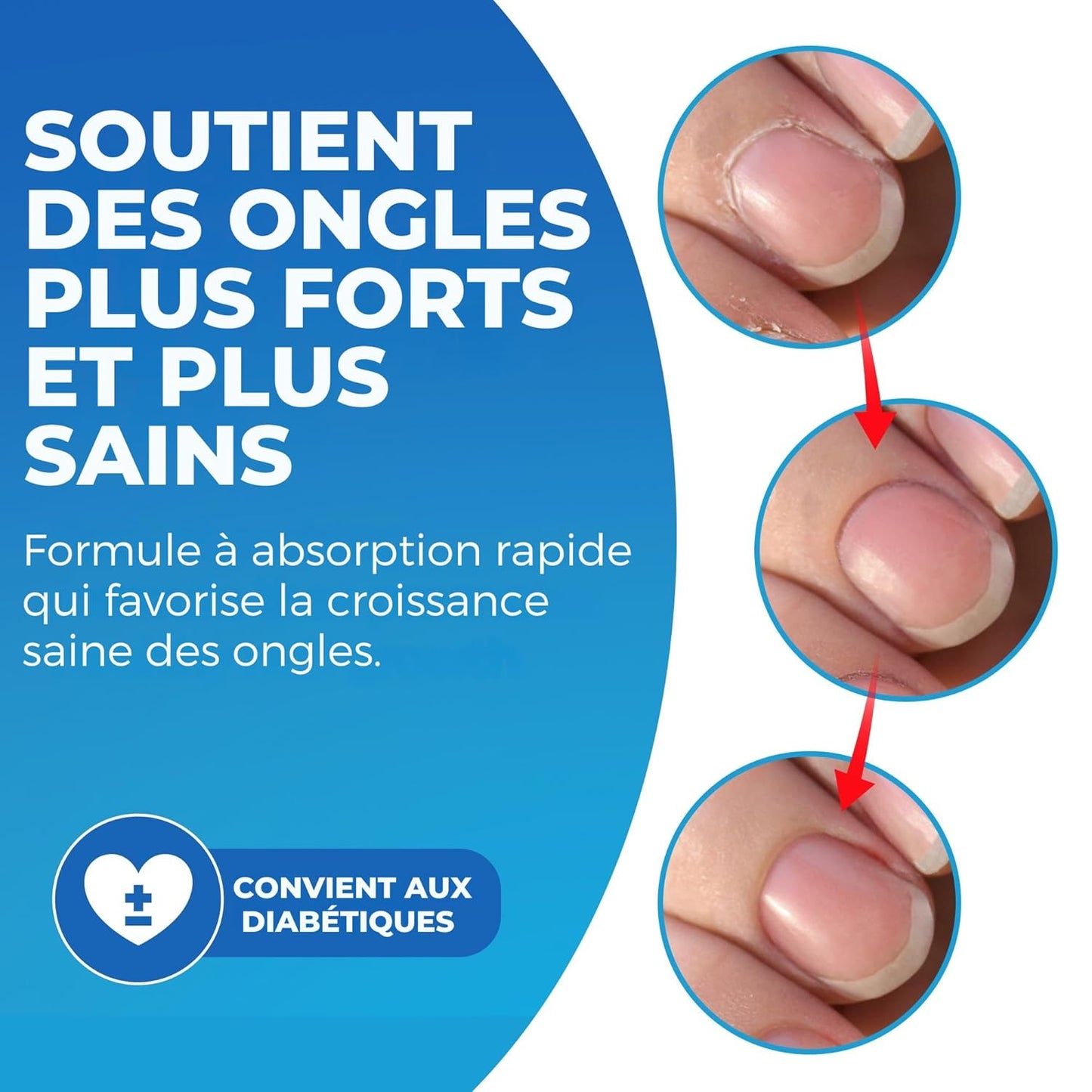 Imperial Feet Cuticle Oil for Nail Growth and Strength 30ml/1 FL Oz-Almond, Jojoba, Vitamin E Oil for Nails and Cuticles-Hydrates, Natural Nail Strengthener and Nourishes Dry Cuticles-Cuticle Softener