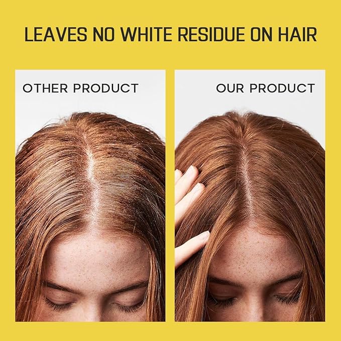 Dry Shampoo for Women, No White Residue Instantly Fresh Shampoo Spray, Absorb oils, Refreshing Volumizing Hair Dry Shampoo 5.07 FL.OZ (Pack of 4)