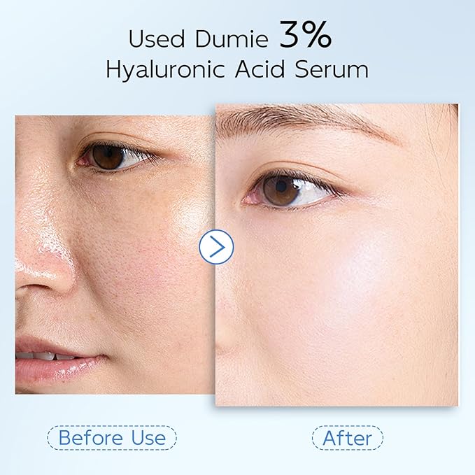 3% Hyaluronic Acid Serum for Face, Anti-Aging Hydrating Serum with 20,000 ppm Ceramide NP & 10,000ppm Acetyl Hexapeptide-8, Korean Skincare ultra hydrating serum, turm Skin/Sensitive Skin(1.5 ml*30)