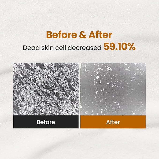 Enzyme Cleansing Powder – 15g (0.53 oz) – Purifies Pores, Removes Blackheads & Whiteheads, With Papain Enzyme for Smooth & Clear Skin | Low pH, Non-Irritating, For Sensitive Skin