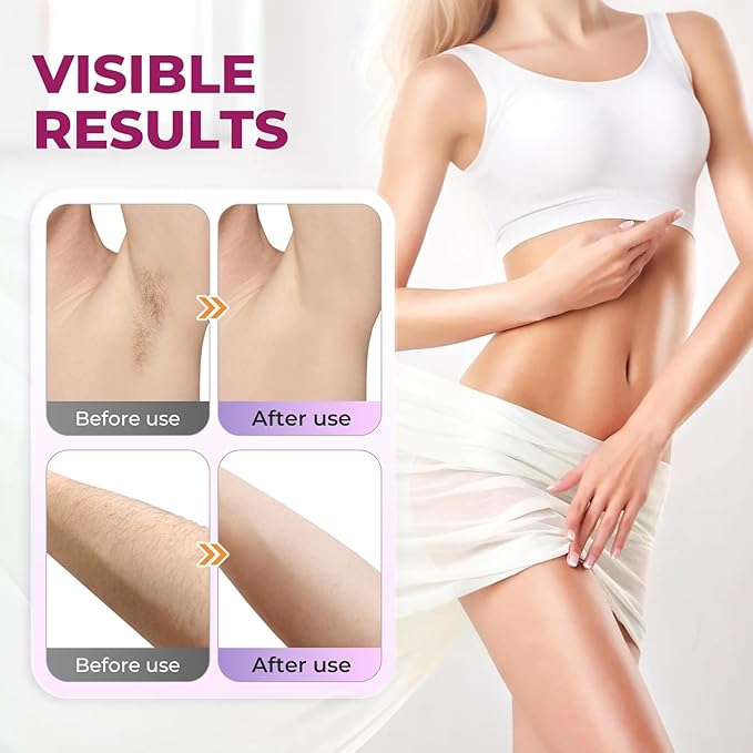 Hair Removal Spray for Women & Men: Hair Removal Cream Sensitive Skin, Painless for All Skin Types, Private Areas, Legs, Bikini, Body, and Back, 7.17OZ