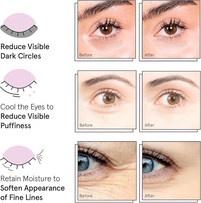 grace & stella Award Winning Under Eye Mask - Travel Essentials - Birthday Gifts for Women - Gel Eye Patches for Dark Circles, Puffy Eyes, Wrinkles, Undereye Bags - Vegan Self Care (48 Pairs, Gold)