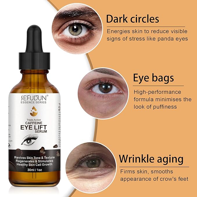 Caffeine Eye Serum, Eye Lift Serum with Vitamin C, Hyaluronic Acid, Collagen - Reduces Puffiness, Dark Circles, Under Eye Bags 1 oz / 30 ml