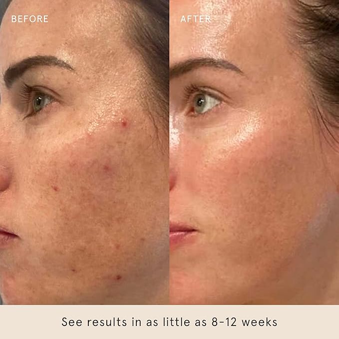 Barefaced Serum Duo - RetinAL & Liquid Gold to Hydrate, Even Skin Tone, & Reduce Signs of Aging