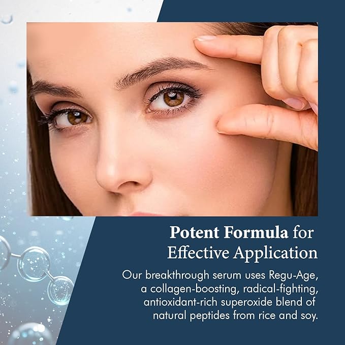 Extreme Dark Circle Serum - Under Eye Treatment for Dark Circles, Puffiness, Wrinkles & Fine Lines - Revitalizing, Anti-Aging & Eye Depuffer Serum for Eye Skin Care l 30 ml