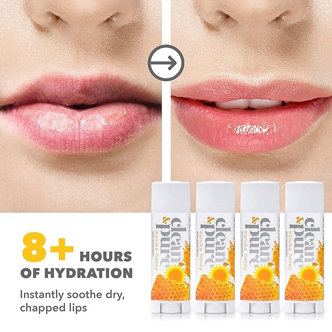 Lip Balm Singles (Manuka Honey with Sunscreen) 100% Natural Beeswax, Vitamin E Oil | Olive Oil Based Treatment for Dry, Chapped Lips | Made in Australia…