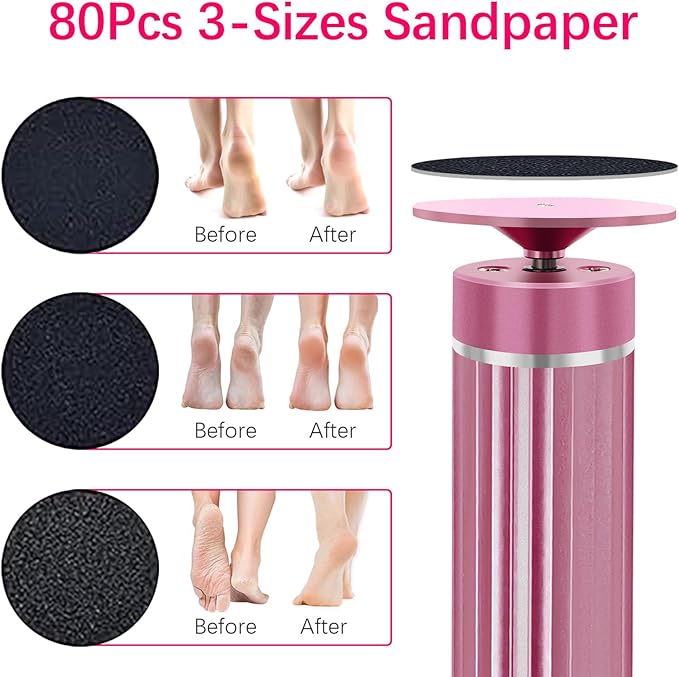 5.3'' Electric Foot Callus Remover with 80pcs Sandpaper Discs & Brush, Professional Aluminum Ergonomic Pedicure Tool, Stepless Speed & Reverse Control for Dead Skin Removal (Pink)