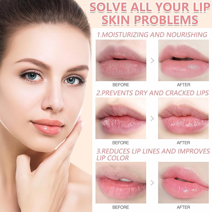 Bee Lip Balm Honey Pot,1Pcs Watermelon Lip Balm Moisturizing Lip Sleeping Mask Hydrating Prevention Dry & Cracked Lip Exfoliator Lip Wrinkle Lip Care Lip Mask Overnight Reduces Lip Line (Watermelon)