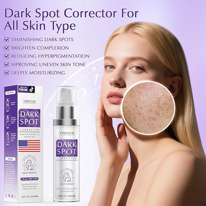 Dark Spot Remover for Face Cream, Dark Spot Corrector, Rapid Tone Repair Retinol Serum for Sun Spots, Age Spots, Skin Brown, Melasma Skin Care with Upgraded Formula Vitamin C for Women 1.7 Fl OZ