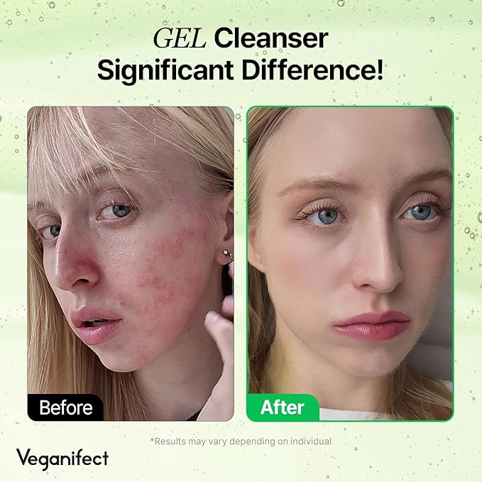 Gel Cleanser, Big Size, Gentle Exfoliation and Face cleanser for Sensitive Skin, Korean Skin Care, Vegan, 6.93 Fl Oz