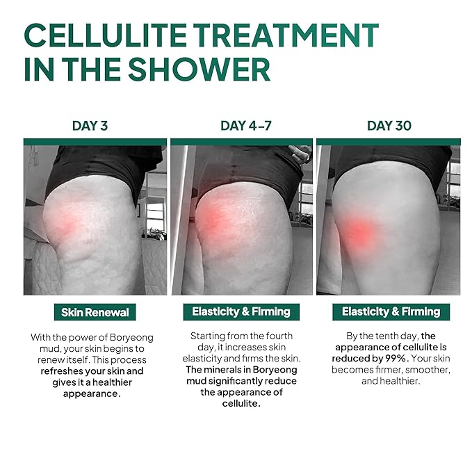 Anti Cellulite Mud Scrub Body Wash, Reduces Cellulite, Gentle Exfoliating, Improves Skin Texture, Provides a Smoother Look, 5.07 Fl Oz (1)