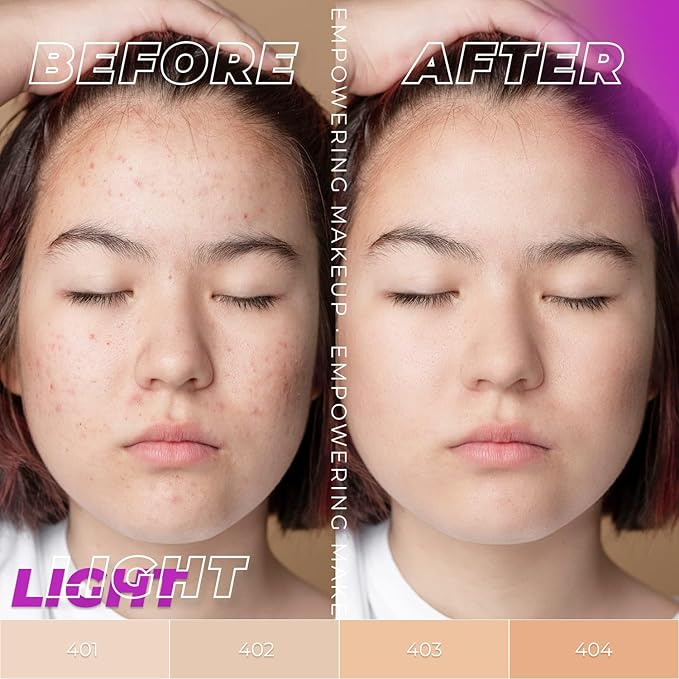 Lamel - Oh my Clear Face Foundation-404 Custard | Contains tea tree extract and salicylic acid |Controls sebum production |Anti-blemish formula |Oil free foundation | 40ml