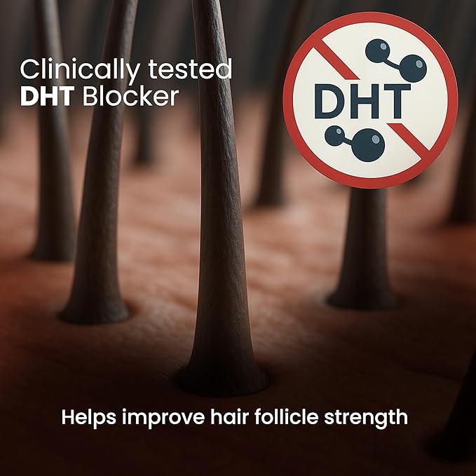 Be Bodywise Rosemary Hair Growth Serum Roll On 25 ml – 3% Rosemary, 3% Redensyl & 2% Anagain | DHT-Blocking Scalp Serum Boosts Oxygen Flow, Reduces Hair Fall | Paraben/Sulfate-Free | Women & Men