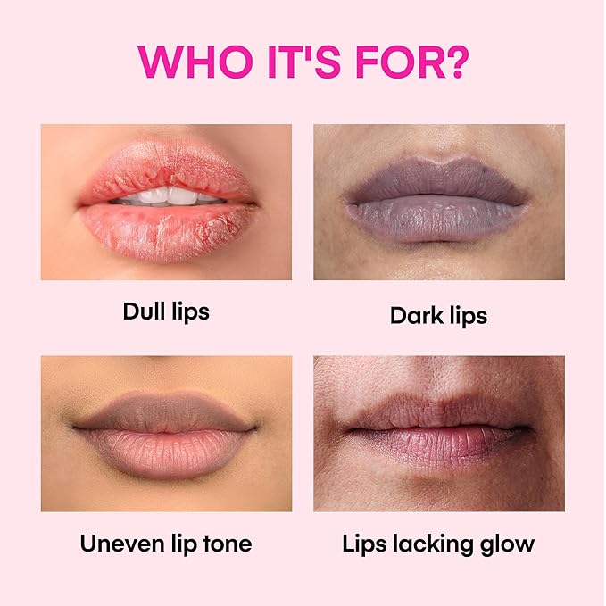 Lip Lightening for Dark Lips: for Smokers, Dry or Uneven-Toned Lips – Restores Natural Look & Moisture with VC, Lemon Peel & Licorice – Refreshing Mint Scent – 15 mL