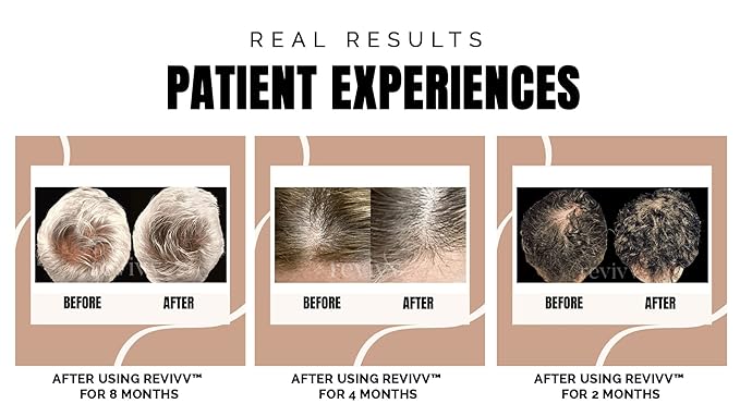 REVIVV Women's Hair Serum 2 Pack | Thicker, Fuller Hair with Our Natural Growth Products | Enhanced Scalp Health and Vitality | Combating Thinning & Packed with Vitamins