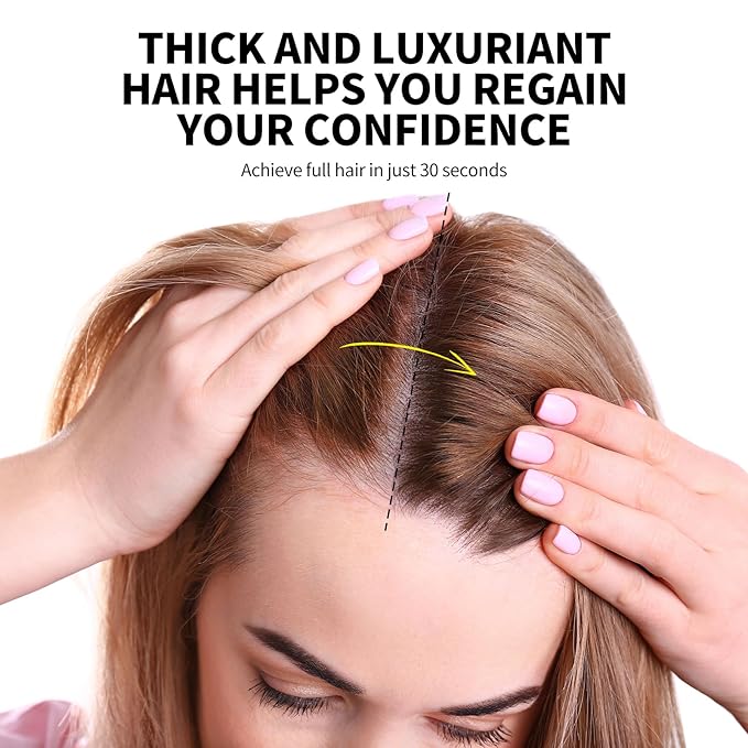 SEVICH Hair Fibers with Spray Applicator - Natural-Looking Hair Thickening Fibers for Men & Women, Instant Fullness, Wind & Water Resistant, Easy Wash Out, 25g (Medium Brown)