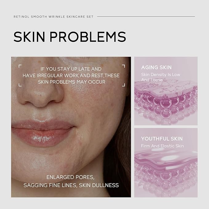 Anti Aging Skin Care Set, 1% Retinol Dark Spot Remover for Face with Face Serum & Moisturizer, Travel Size Skincare Set for Women, Reduce Wrinkles, Firm & Hydrate for All Skin Types