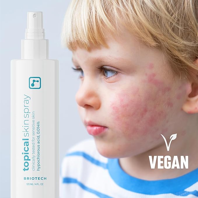 BRIOTECH Topical Skin Spray, Hypochlorous Acid for Sensitive Skin, HOCl Facial Mist, Full Body Support Against Irritation, Calm Redness, Soothe Foot & Scalp, 1 Gallon Refill (2 Pack)