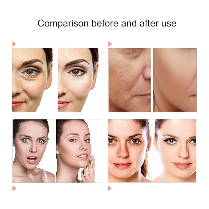 7 Color LED Face Mask LED Light Therapy Equipment for Skin Care at Home