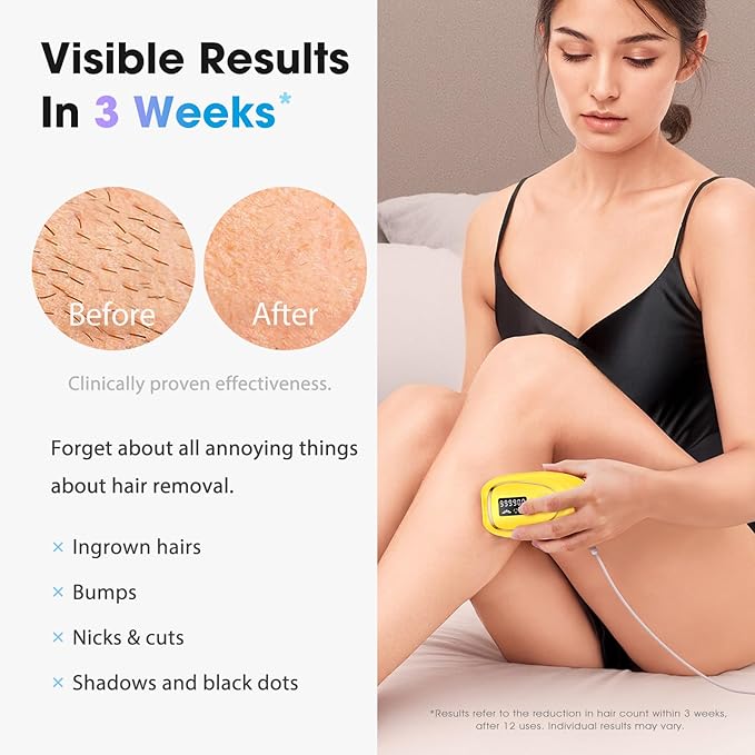 IPL Laser Hair Removal Device for Women & Men - Home 45°F Ice-Cooling Contact for Painless & Long-Lasting Results, 86% Hair Reduction in 3 Weeks for Full Body & Bikini Line, Light Yellow