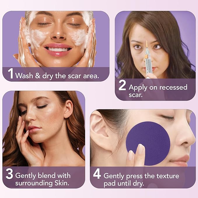 Dermaflage Scar Filler Kit - Bronze Medium - Deep Scar Cover and Waterproof Concealer for Acne Scars Wrinkles, and Ice Pick Scars Makeup, 1 mo supply