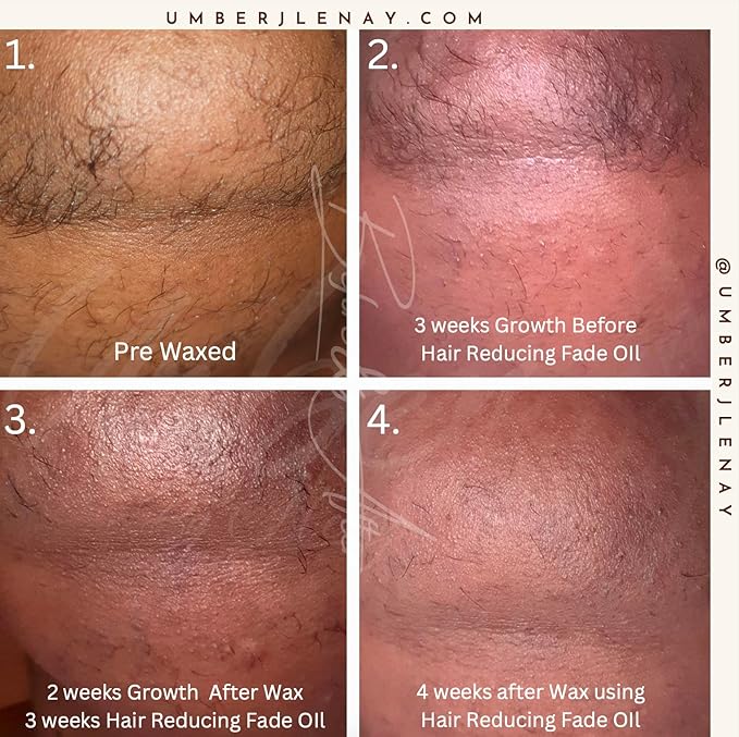 Hair Reducing Fade Oil – Regular Strength (Not sensitive skin), Minimizes Hair Growth for Face & Body – For Women & Men – 15ml Serum