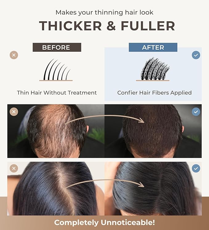 Keratin Hair Fibers for Men & Women - Fill In Fine or Thinning Hair, Instantly Thicker, Fuller Looking Hair (Gray 15g)