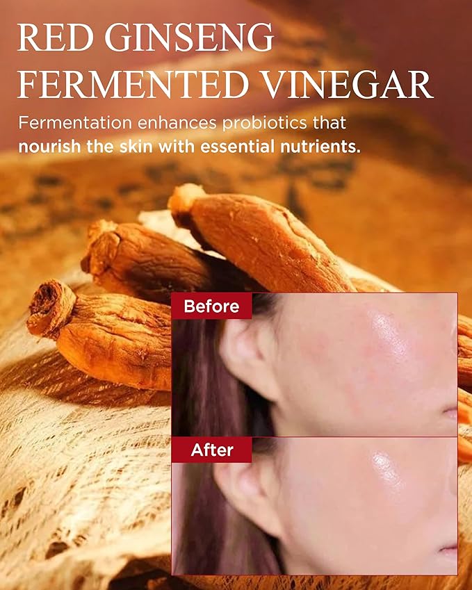 Bonyongo Red Ginseng Vinegar Essence– Revitalizing & Intensive Nourishing for All Skin Types - Hydrated and Glowing Skin with Fermented Red Ginseng - Korean Skincare, 1.5 fl.oz.