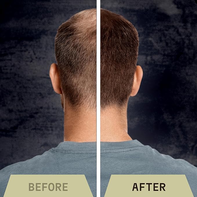 Striking Viking Hair Fibers for Thinning Hair - Building Fibers (Light Blonde) 28g - Naturally Derived Formula - Long Lasting Powder for Undetectable, Thicker Looking Results for Men & Women