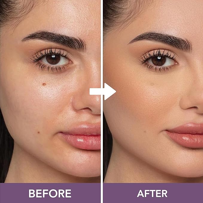 Dermaflage Waterproof Concealer Cream (Espresso) - Concealer Full Coverage, Matte Finish for Face & Body - Hides Dark Circles, Tattoos & Acne - Long Lasting Formula Used by Hollywood Makeup Artists