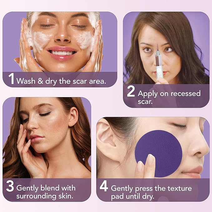 Dermaflage Scar Filler Kit - Deep - Deep Scar Cover and Waterproof Concealer for Acne Scars Wrinkles, and Ice Pick Scars Makeup, 1 mo supply