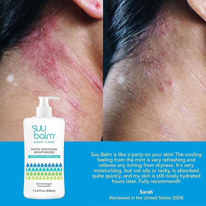 Fast Itching Relief Cream, Anti Itch Lotion for Sensitive Skin, Eczema, Psoriasis & Extreme, Very Severe & Dry Skin, Derm Formula, Menthol & Ceramides, 11.83 fl oz